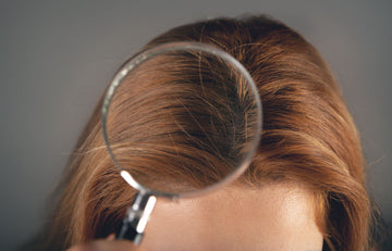 Plaukų slinkimas: problemos, priežastys ir sprendimai